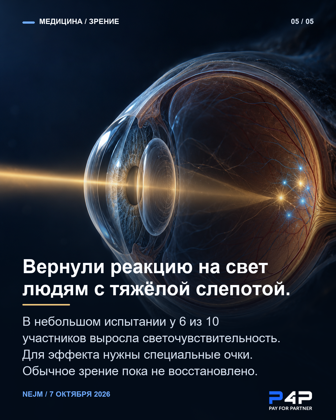 Экспериментальная оптогенетическая терапия: у 6 из 10 участников выросла чувствительность к свету.