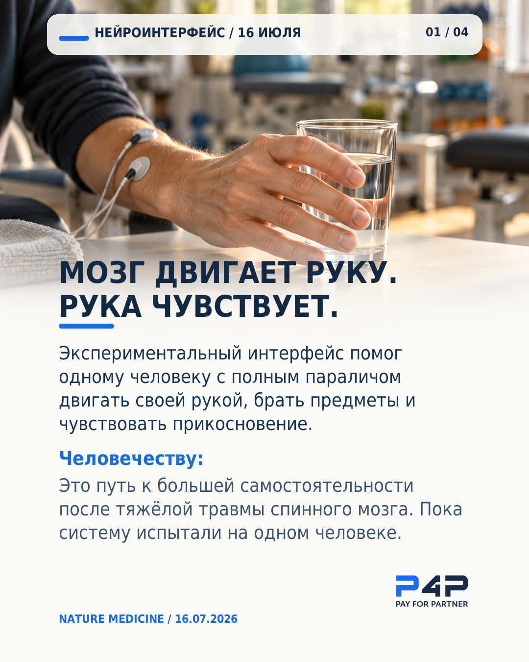 Нейроинтерфейс помог двигать рукой и чувствовать прикосновение.