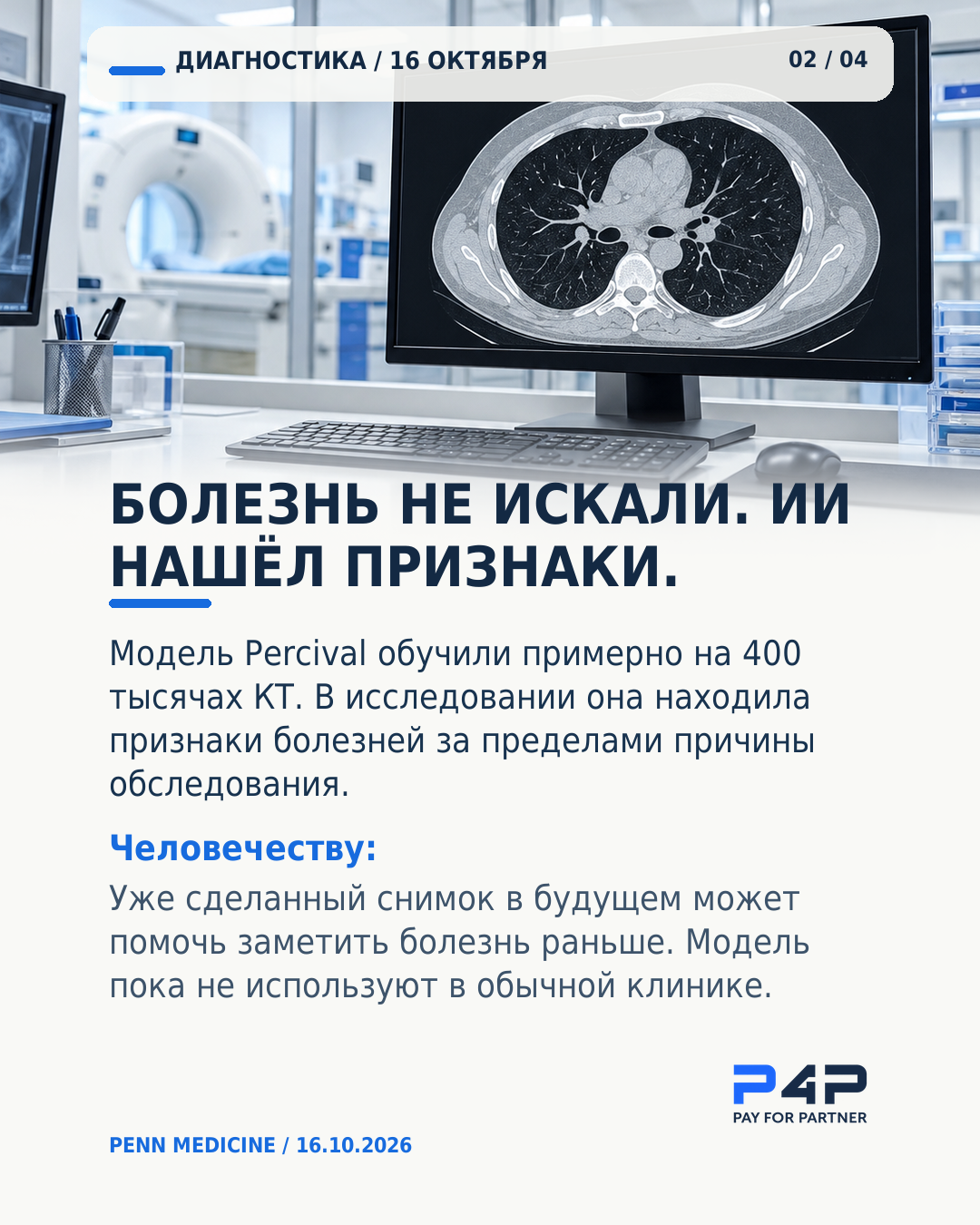 Модель Percival нашла дополнительные признаки болезней на снимках КТ.